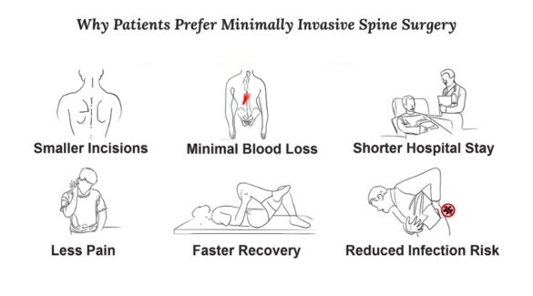 Minimally Invasive Spine Surgery