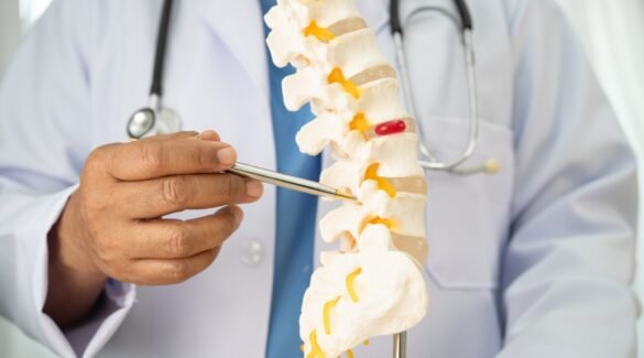 Cervical Spondylosis Doctor in Mumbai