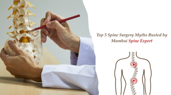 Top 5 Spine Surgery Myths Busted by Mumbai Spine Expert