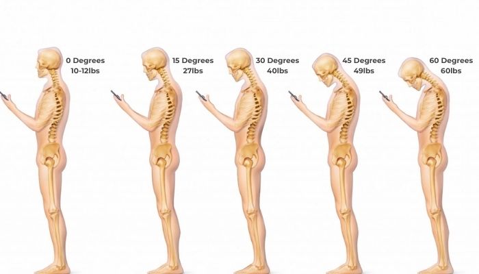 Neck Pain Causes and Treatment | Dr. Rakesh Dhake