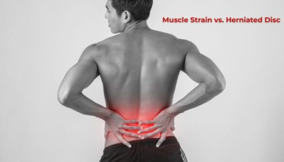 Muscle Strain vs. Herniated Disc