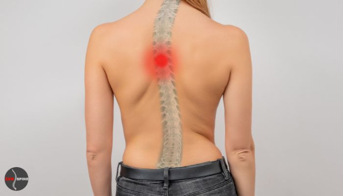Scoliosis Detection and Treatment in Mumbai | Zen Spine | Dr. Rakesh Dhake